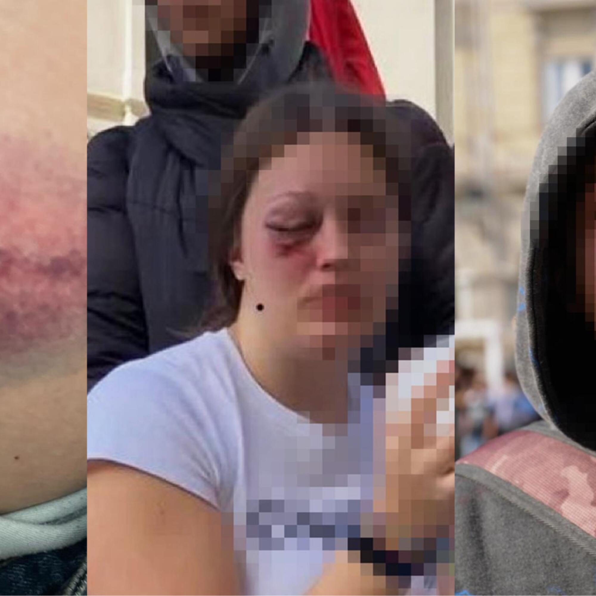 jovenes heridos a coruña