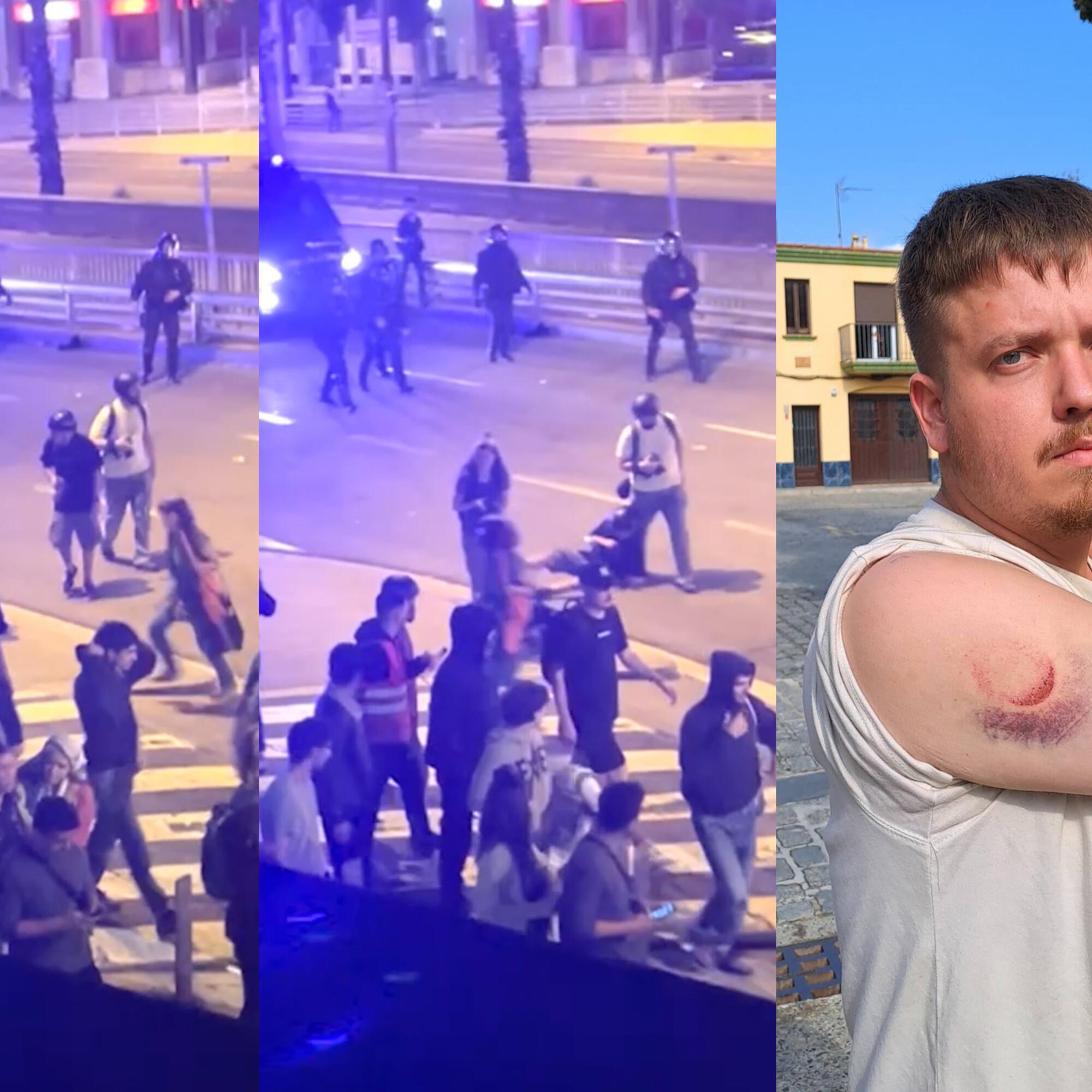 Joan Galvez Herido bala Foam