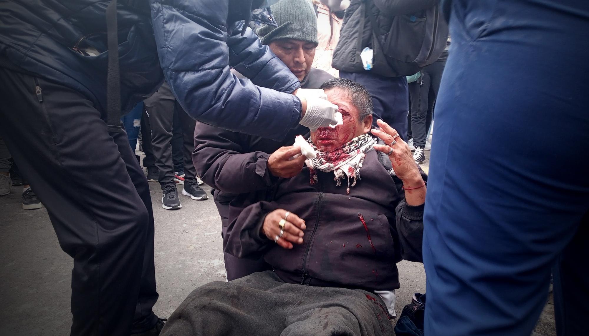 La represión ordenada por el gobernador de la provincia de Jujuy, Gerardo Morales, ha provocado centenares de heridos.