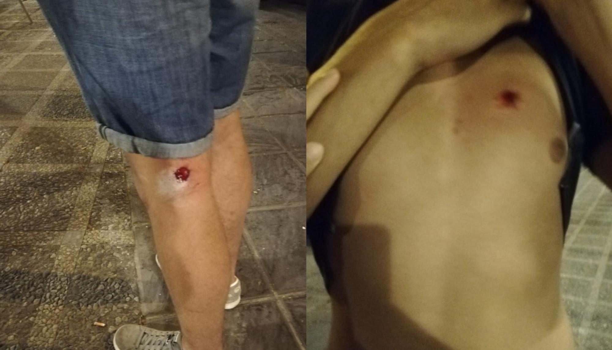 Granada -pablo violencia policial