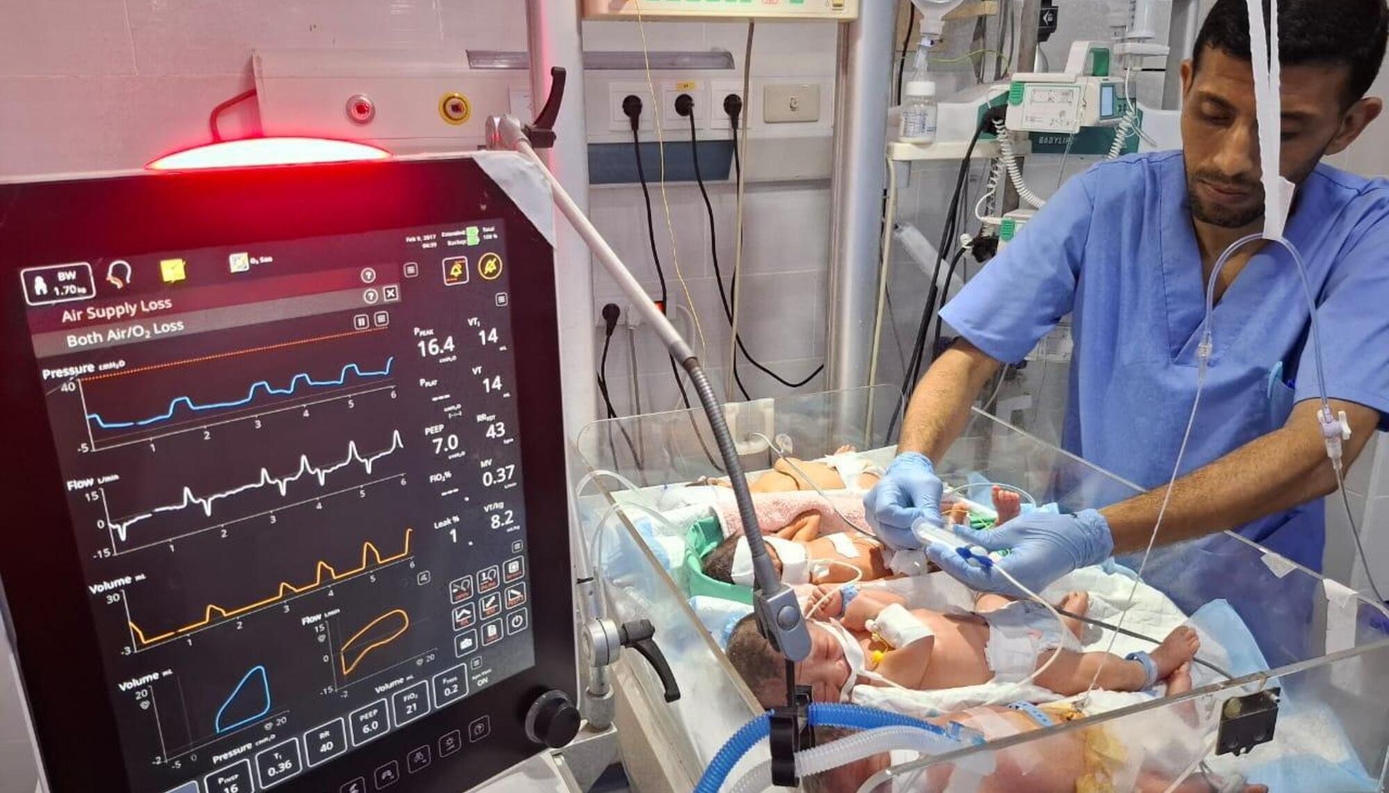 Malnutrición Gaza